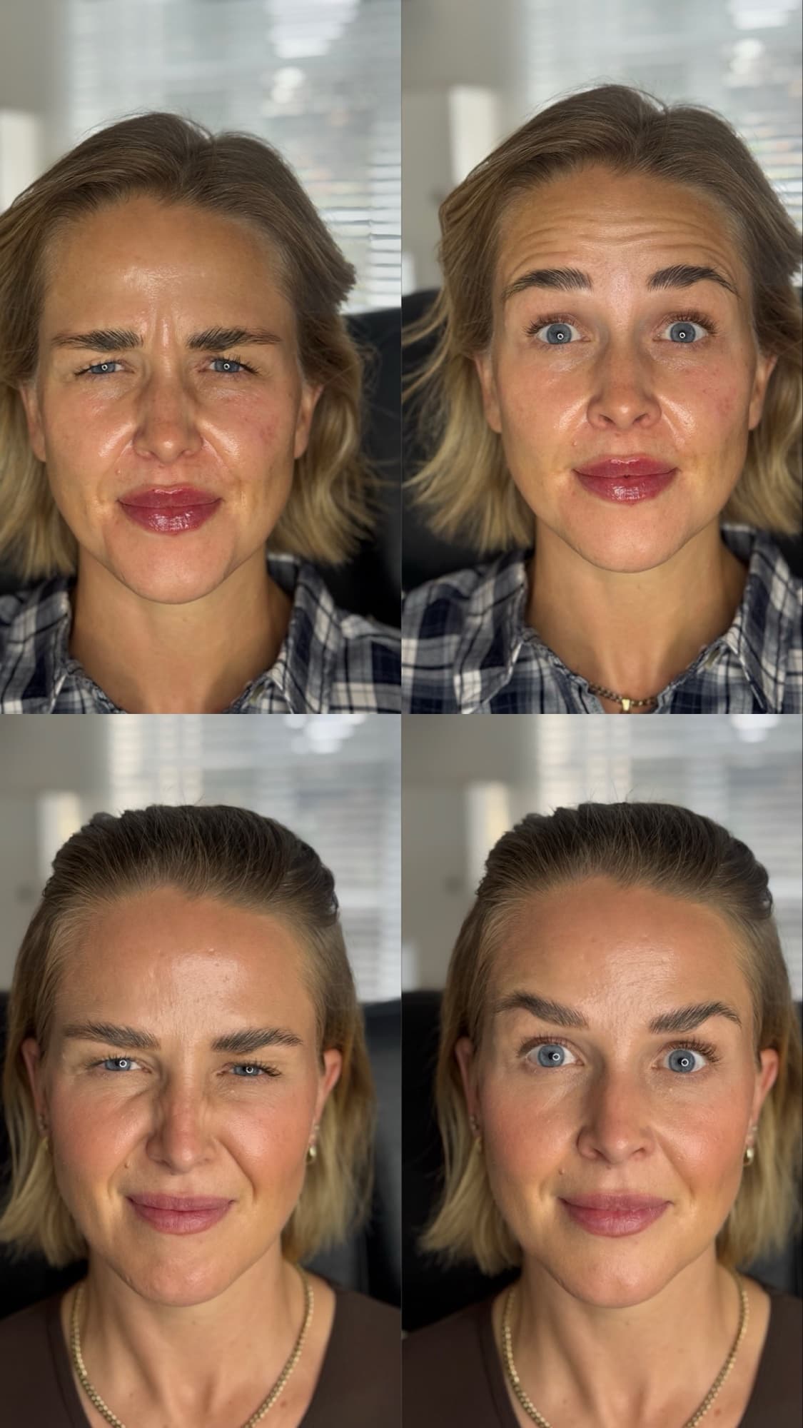 Anti wrinkle before and after