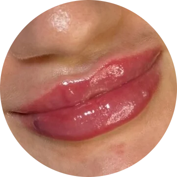 Dissolve and Refill Lips Treatment